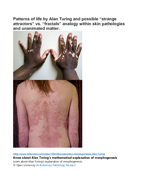 (DOC) Patterns of life by Alan Turing and possible analogy in skin ...