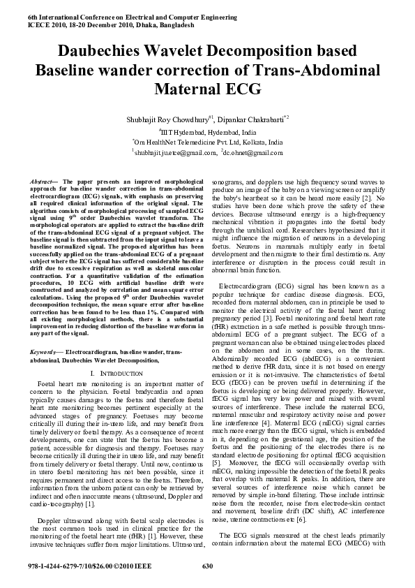(PDF) Daubechies wavelet decomposition based baseline wander correction ...