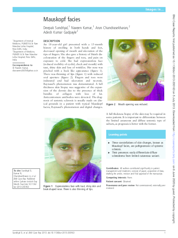 (PDF) Mauskopf facies