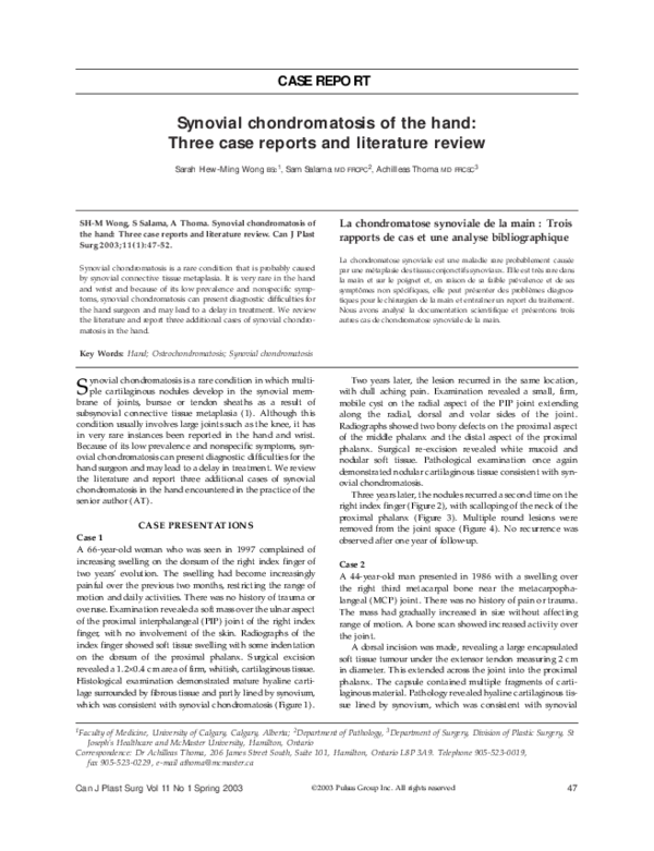 (PDF) Synovial chondromatosis of the hand Three case reports and