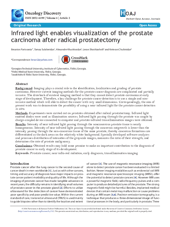(PDF) Infrared light enables visualization of the prostate carcinoma ...