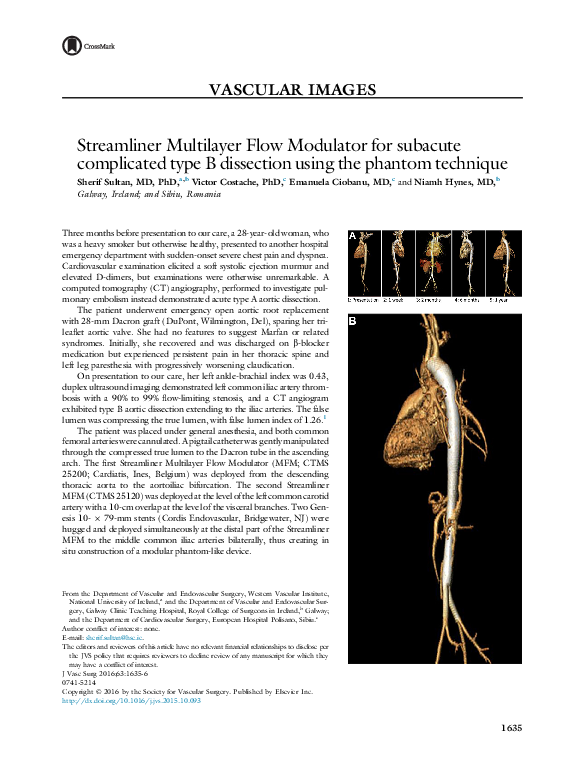 (PDF) Streamliner Multilayer Flow Modulator for subacute complicated ...