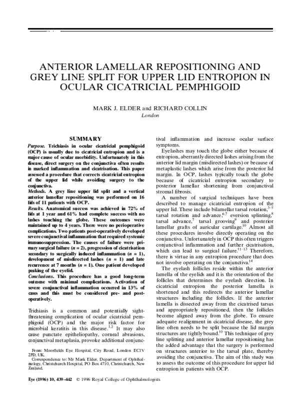 (PDF) Anterior lamellar repositioning and grey line split for upper lid ...