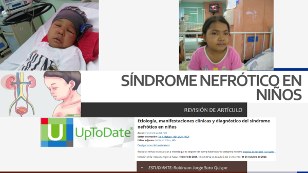 (PDF) SÍNDROME NEFRÓTICO EN NIÑOS