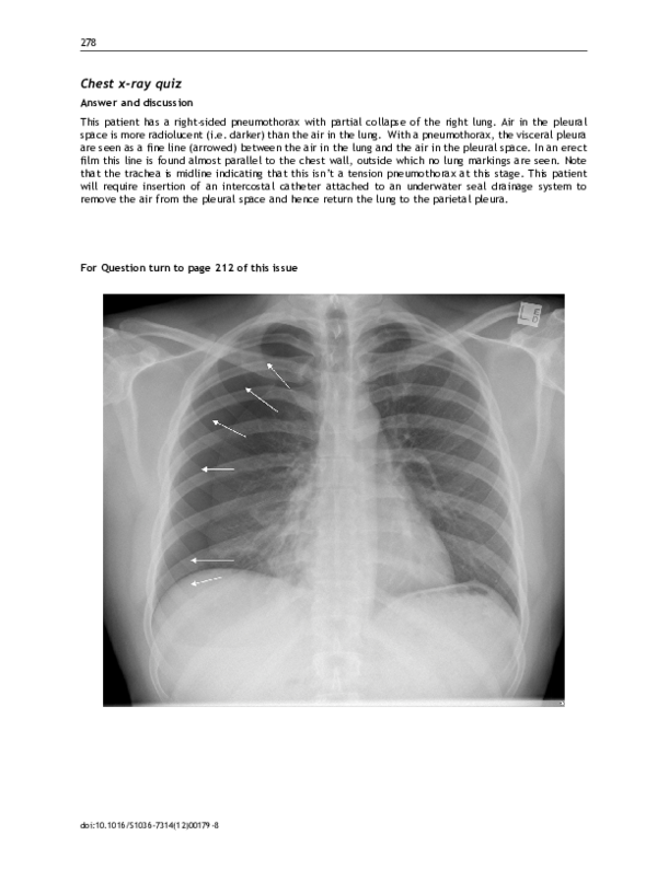 (PDF) Chest X-ray (Answer & Discussion)