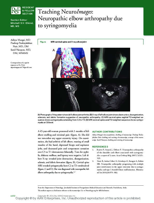 (PDF) Teaching NeuroImages: Neuropathic elbow arthropathy due to ...