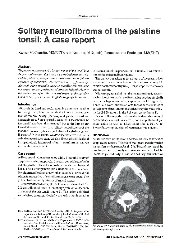 (PDF) Solitary neurofibroma of the palatine tonsil: a case report