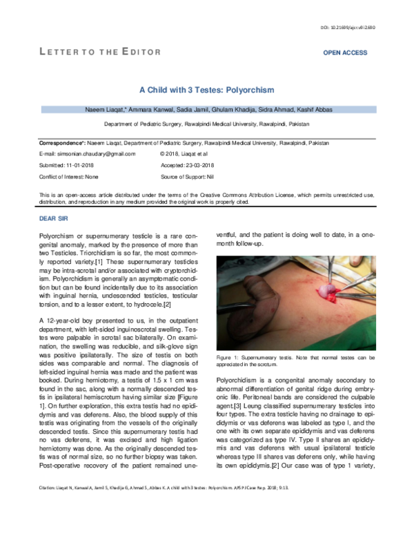 (PDF) A Child with 3 Testes: Polyorchism