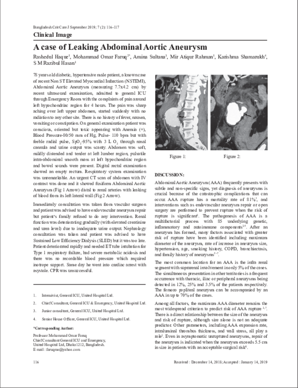 (PDF) A case of Leaking Abdominal Aortic Aneurysm