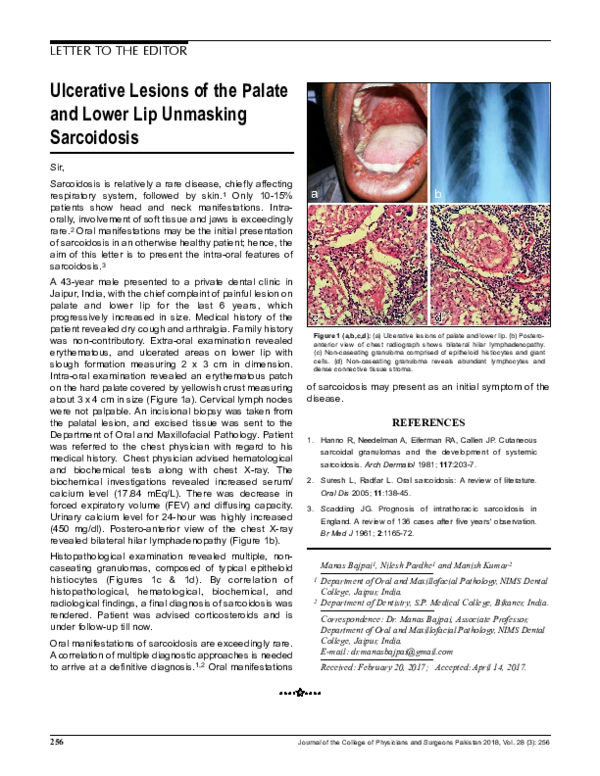 PDF) Ulcerative Lesions of the Palate and Lower Lip Unmasking