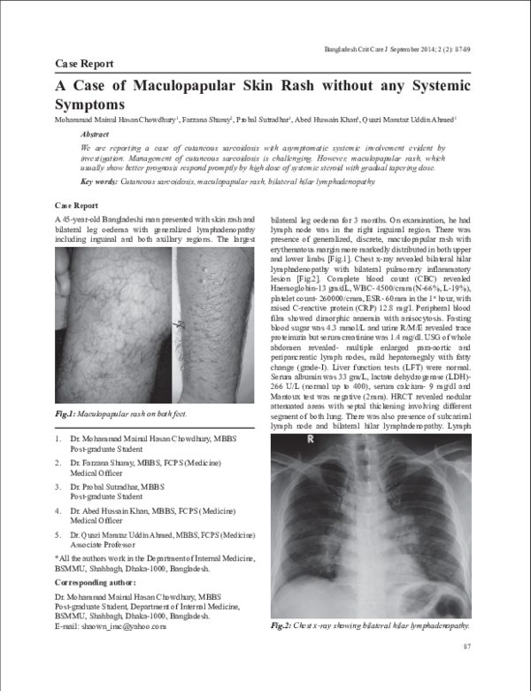 (PDF) A Case of Maculopapular Skin Rash without any Systemic Symptoms