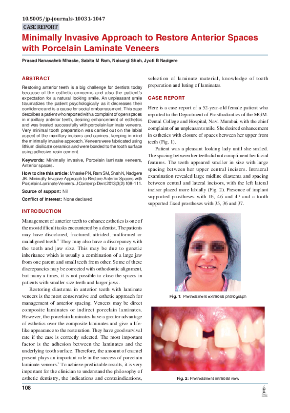 (PDF) Porcelain Laminate Veneers Minimal Tooth Preparation by Design