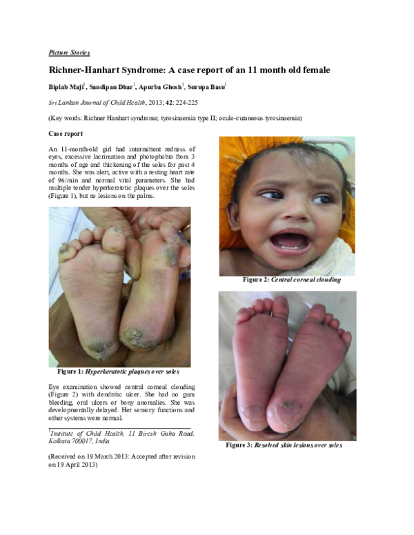Richnerhanhart Syndrome Pdf _ Keratoderma palmoplantaris – CYEZ