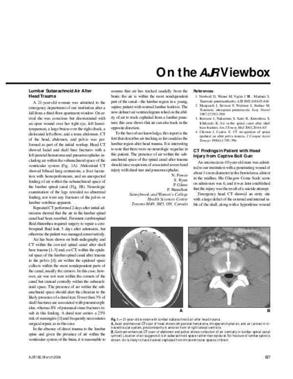 (PDF) CT Findings in Patient with Head Injury from Captive Bolt Gun