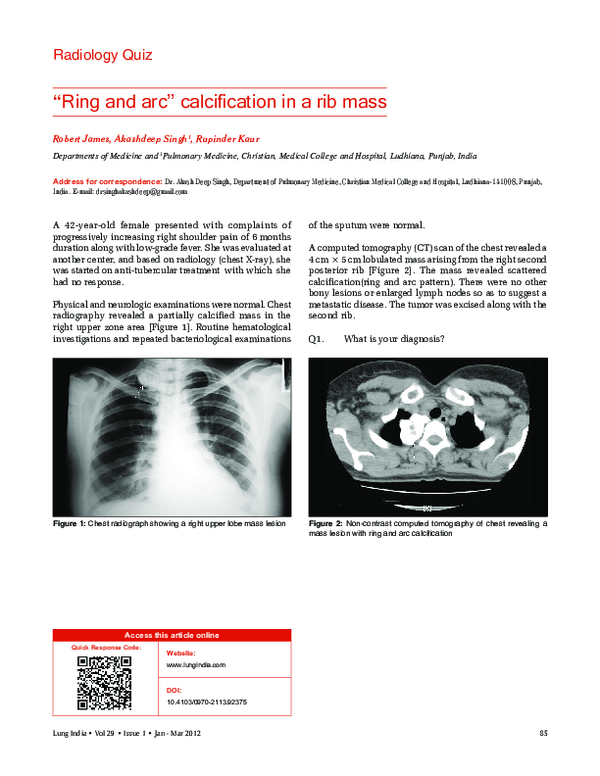 (PDF) Ring and arc′′ calcification in a rib mass