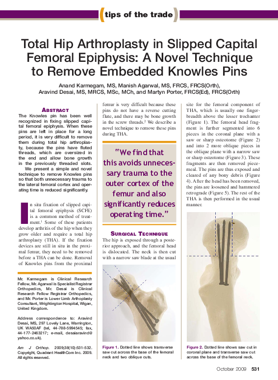 (PDF) Total hip arthroplasty in slipped capital femoral epiphysis: a ...