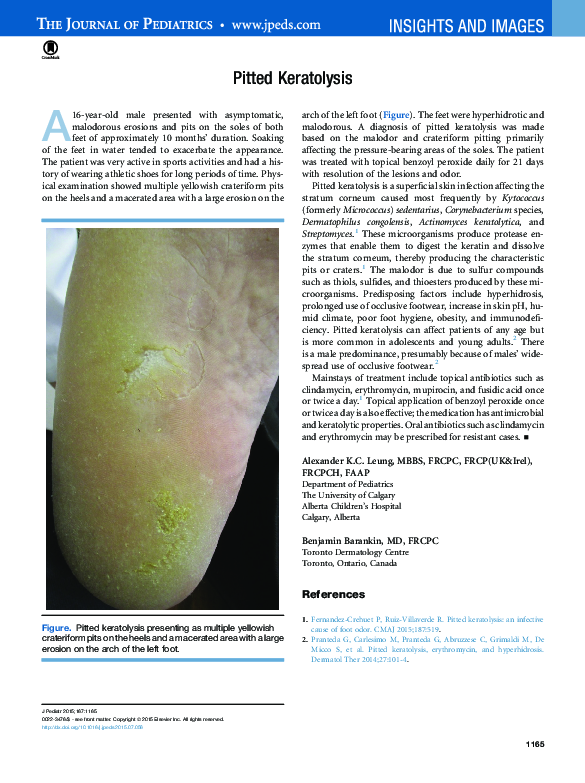 (PDF) Pitted Keratolysis Alexander Leung Academia.edu