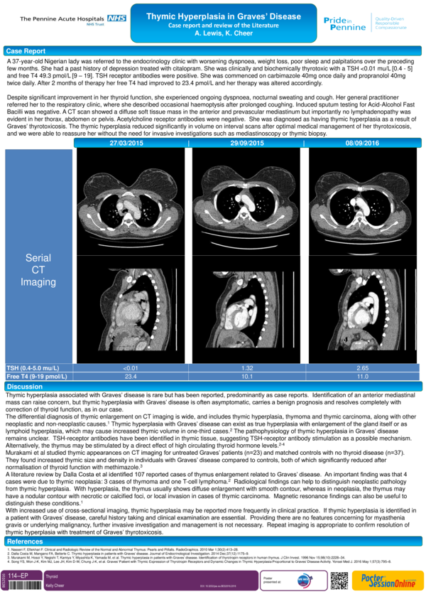(PDF) Thymic hyperplasia in Graves′ disease Suemi Marui Academia.edu