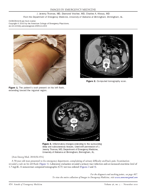 (PDF) Man With Back Pain and Rash