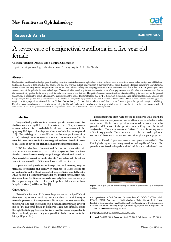 (PDF) A severe case of conjunctival papilloma in a five year old female