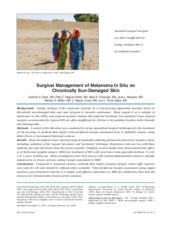 (PDF) Surgical management of melanoma in situ on chronically sun ...
