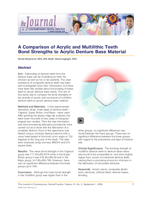(PDF) A comparison of acrylic and multilithic teeth bond strengths to