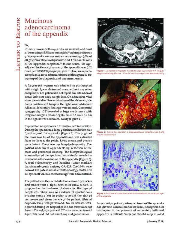 (PDF) Mucinous adenocarcinoma of the appendix