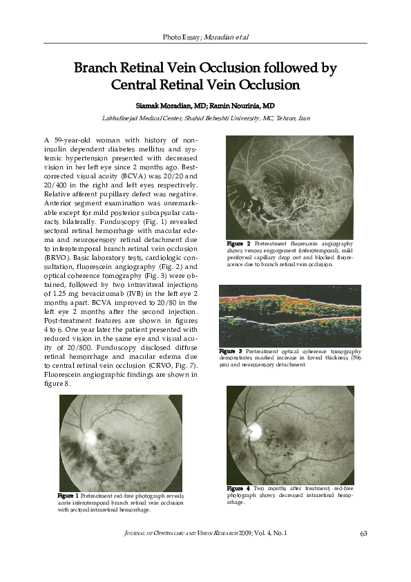 (PDF) Branch retinal vein occlusion followed by central retinal vein ...