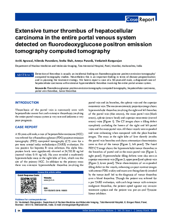 (PDF) Extensive tumor thrombus of hepatocellular carcinoma in the ...
