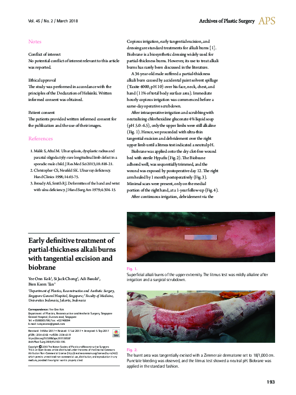 (PDF) Early definitive treatment of partial-thickness alkali burns with ...
