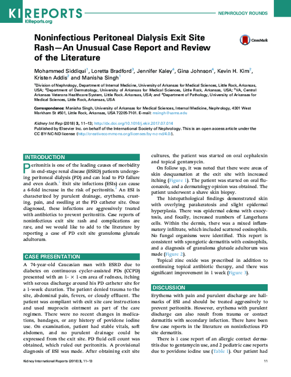 (PDF) Noninfectious Peritoneal Dialysis Exit Site Rash—An Unusual Case ...