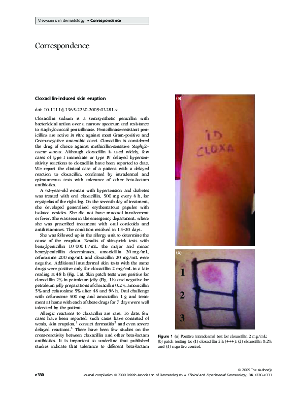 (PDF) Cloxacillin-induced skin eruption