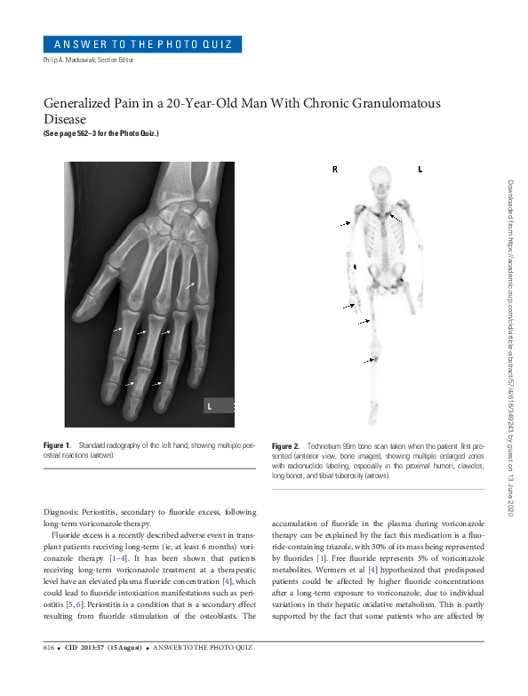 (PDF) Generalized Pain in a 20-Year-Old Man With Chronic Granulomatous ...