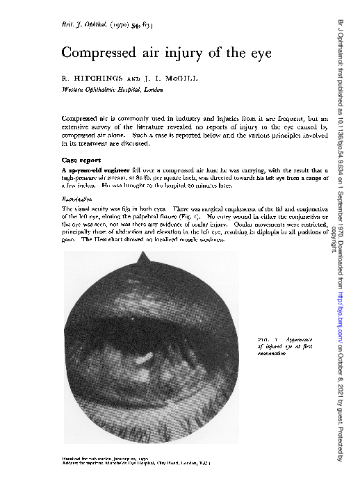 (PDF) Compressed air injury of the eye R. Hitchings Academia.edu