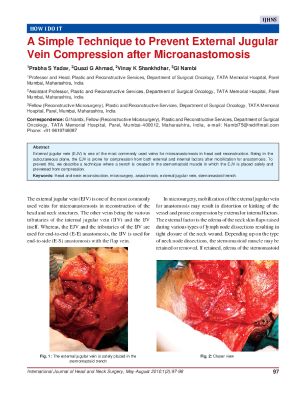 (PDF) A Simple Technique to Prevent External Jugular Vein Compression ...