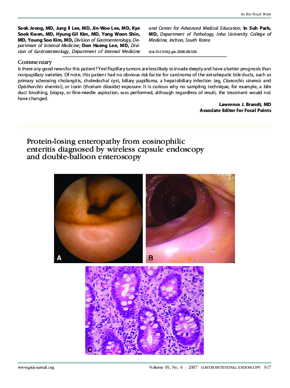 (PDF) Proteinlosing enteropathy from eosinophilic enteritis diagnosed