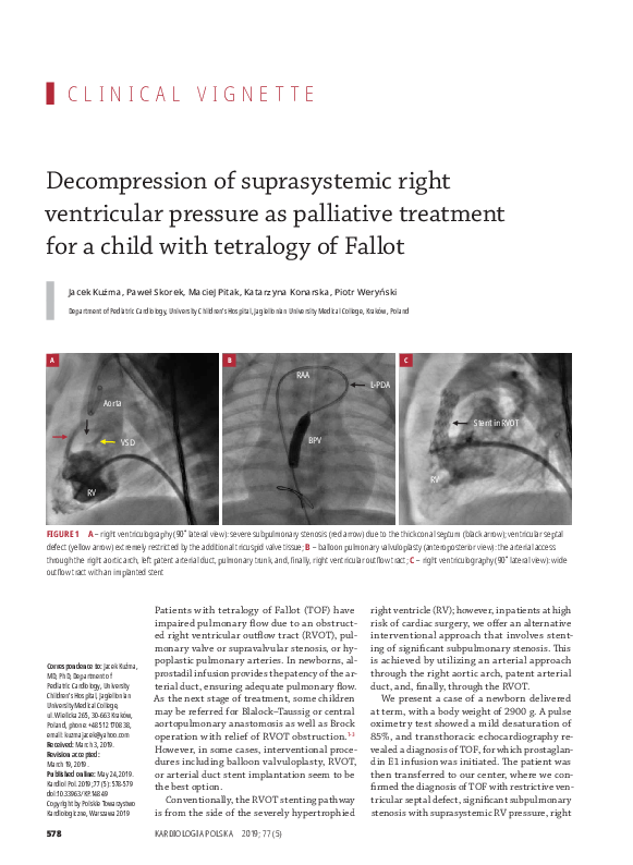 (PDF) Decompression of suprasystemic right ventricular pressure as ...