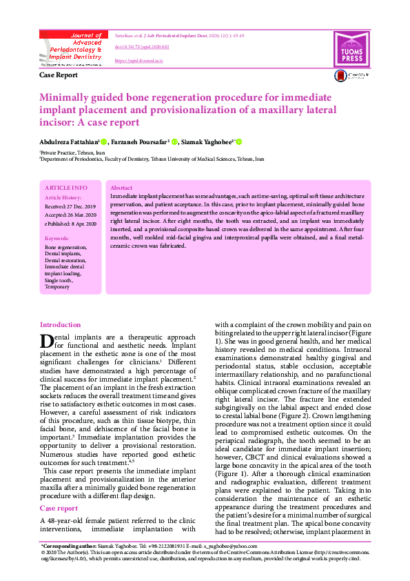 (PDF) Minimally guided bone regeneration procedure for immediate ...
