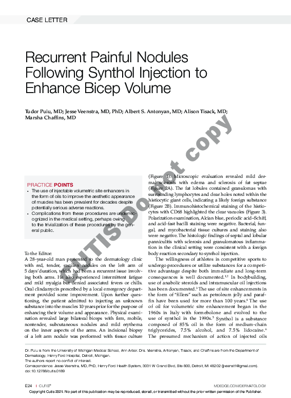 (PDF) Recurrent Painful Nodules Following Synthol Injection to Enhance ...