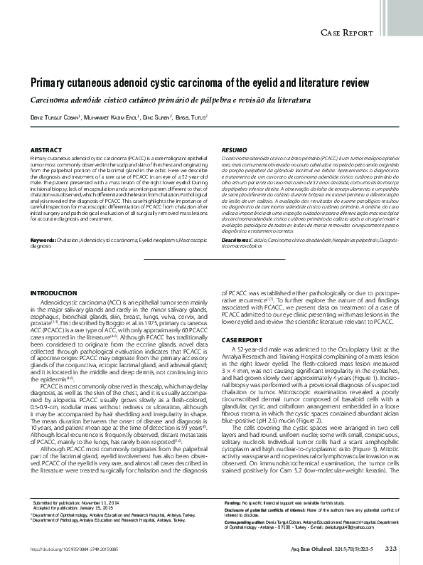 (PDF) Primary cutaneous adenoid cystic carcinoma of the eyelid