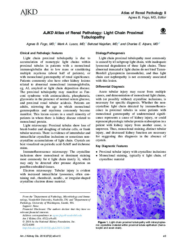(PDF) AJKD Atlas of Renal Pathology: Light Chain Proximal Tubulopathy