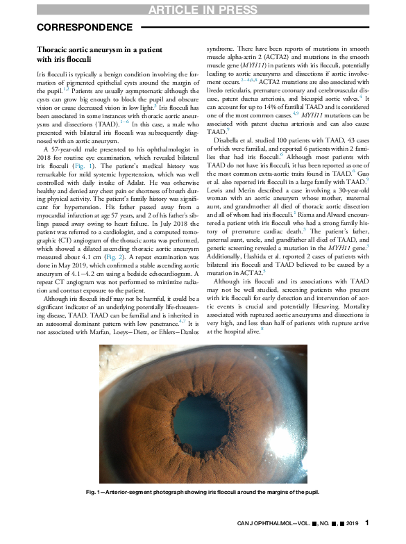 (PDF) Thoracic aortic aneurysm in a patient with iris flocculi Gdih