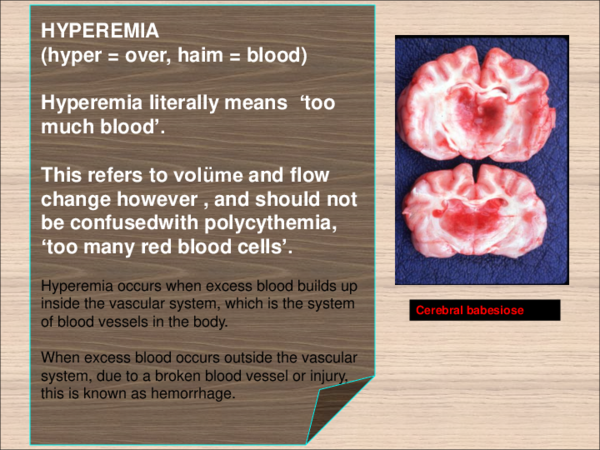 (PDF) HYPEREMIA