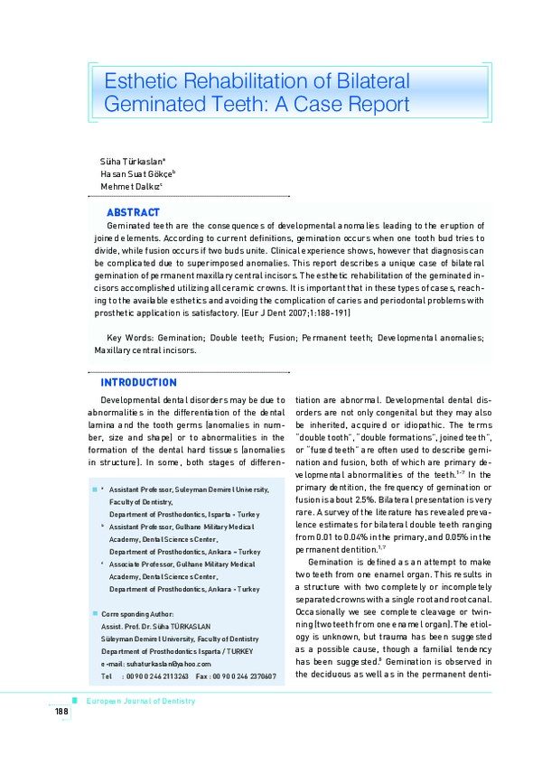 (PDF) Esthetic rehabilitation of bilateral geminated teeth: a case report