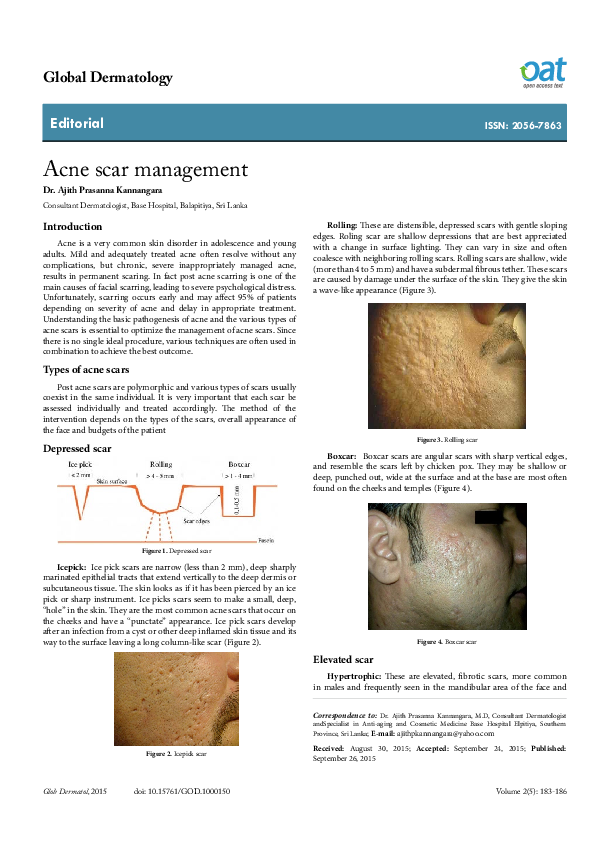 (PDF) Acne scar management