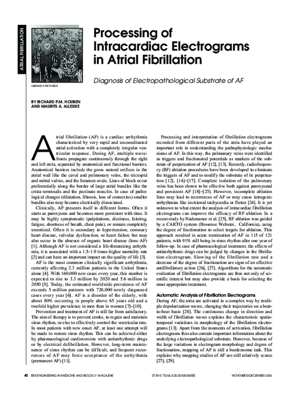 (PDF) Processing of intracardiac electrograms in atrial fibrillation