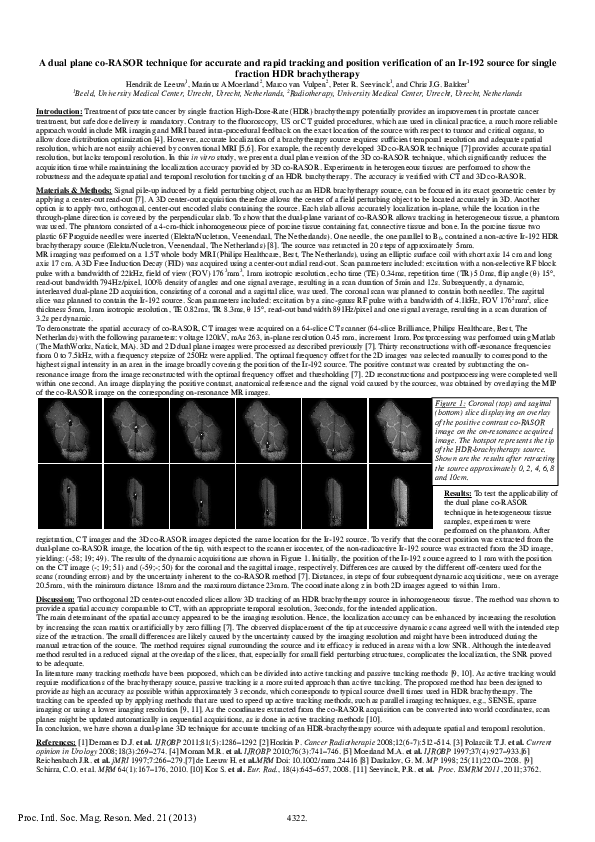 (PDF) A dual-plane co-RASOR technique for accurate and rapid tracking ...