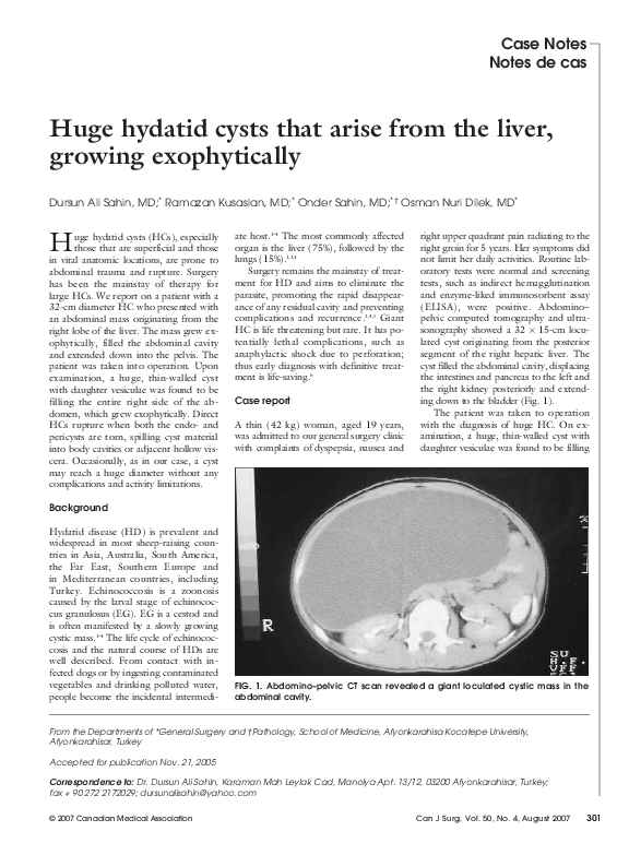 (PDF) Huge hydatid cysts that arise from the liver, growing exophytically