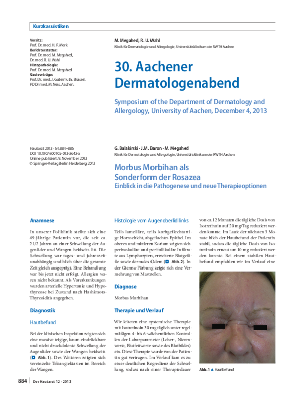 (PDF) Morbus Morbihan als Sonderform der Rosazea