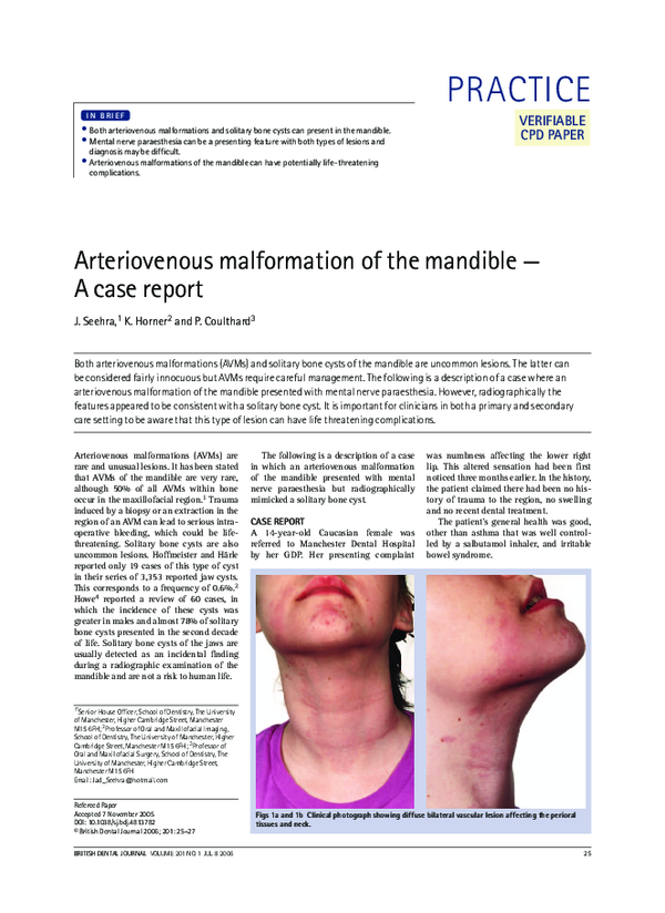 (PDF) Arteriovenous malformation of the mandible — A case report